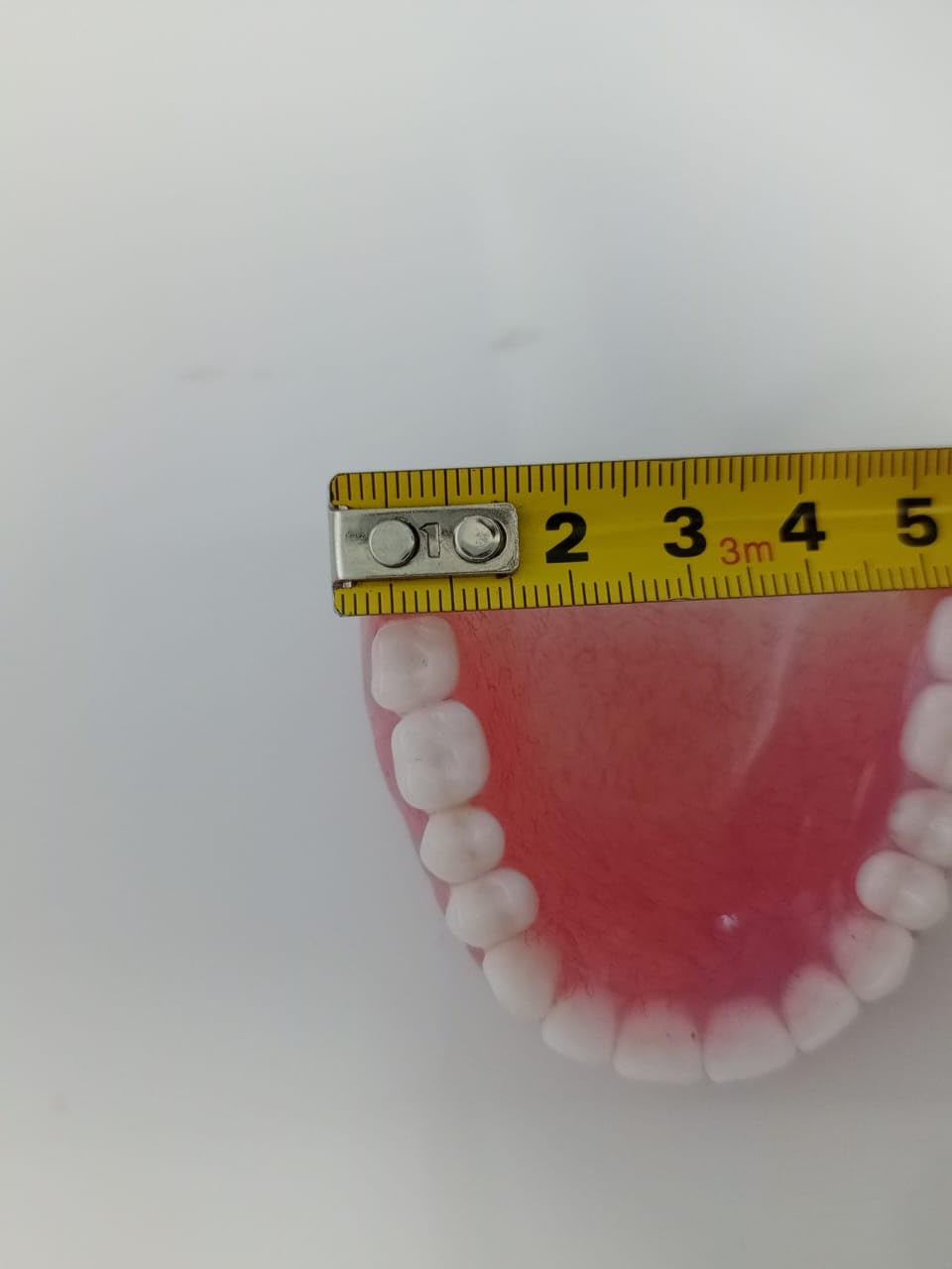 Upper Denture R465