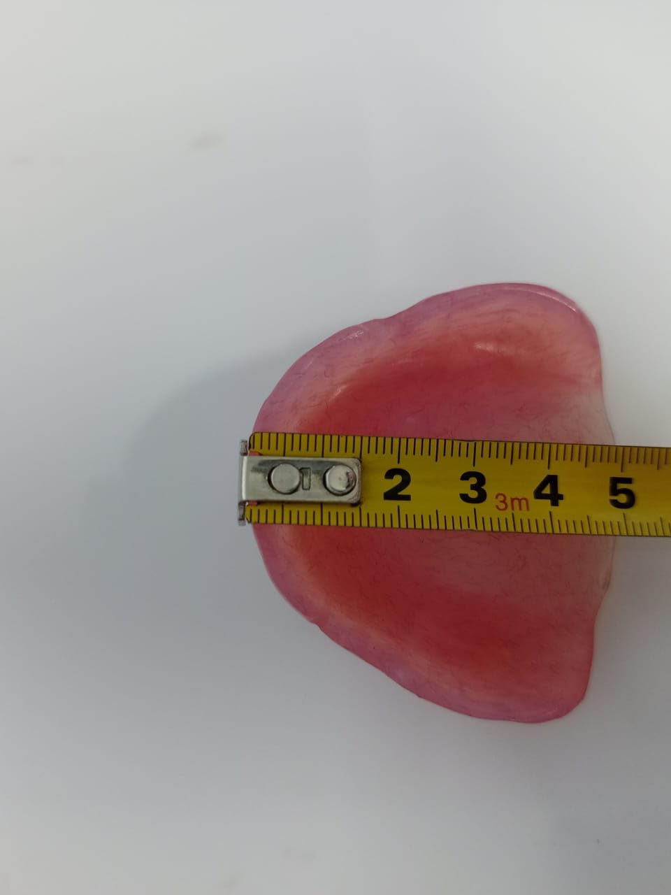 Upper Denture R465